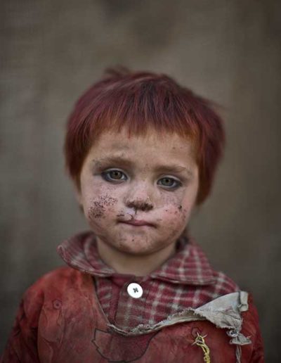 Victims of War