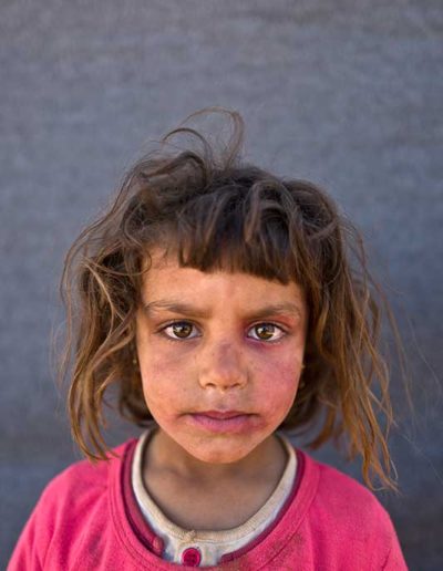 Victims of War